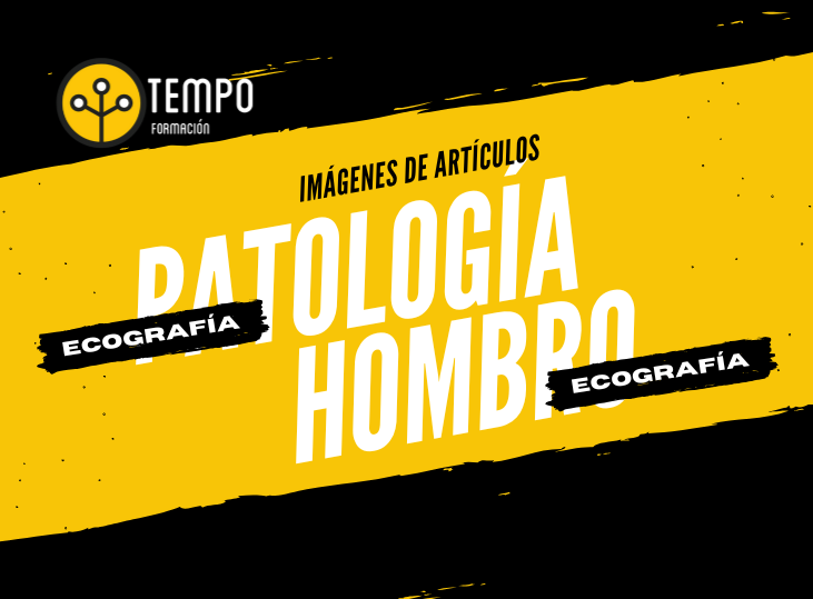 patologia-de-hombro-y-ecografia